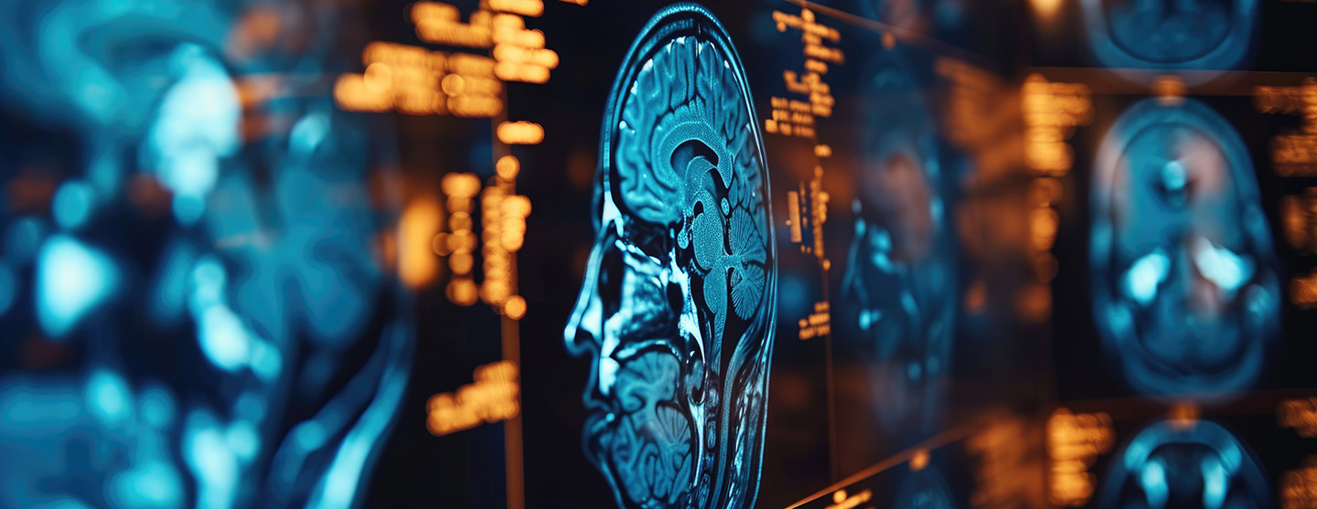 Imagerie médicale