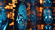Imagerie médicale
